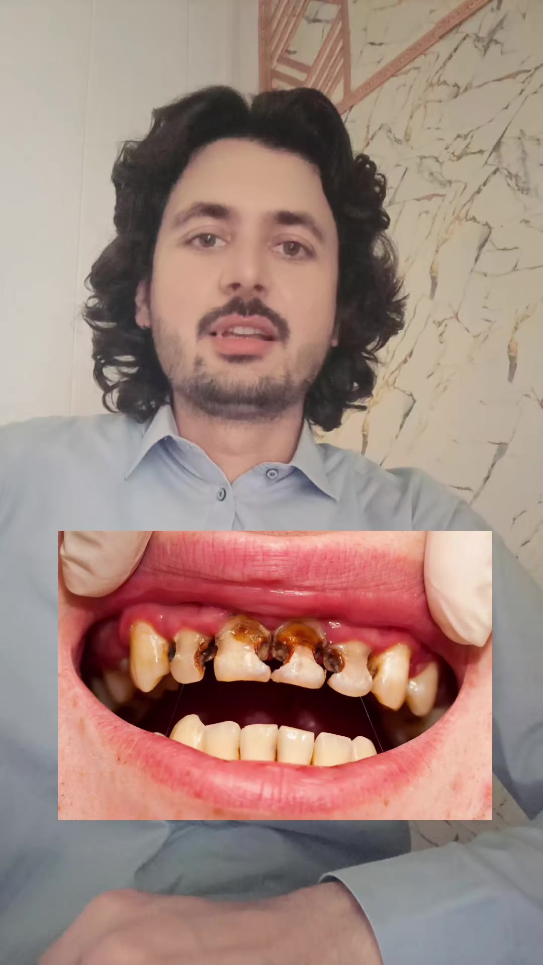 @Dr_sheraz_official 🦷