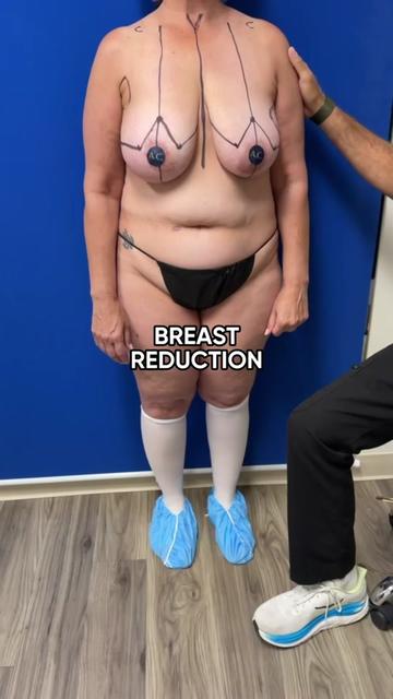 @Cohen MD Plastic Surgery