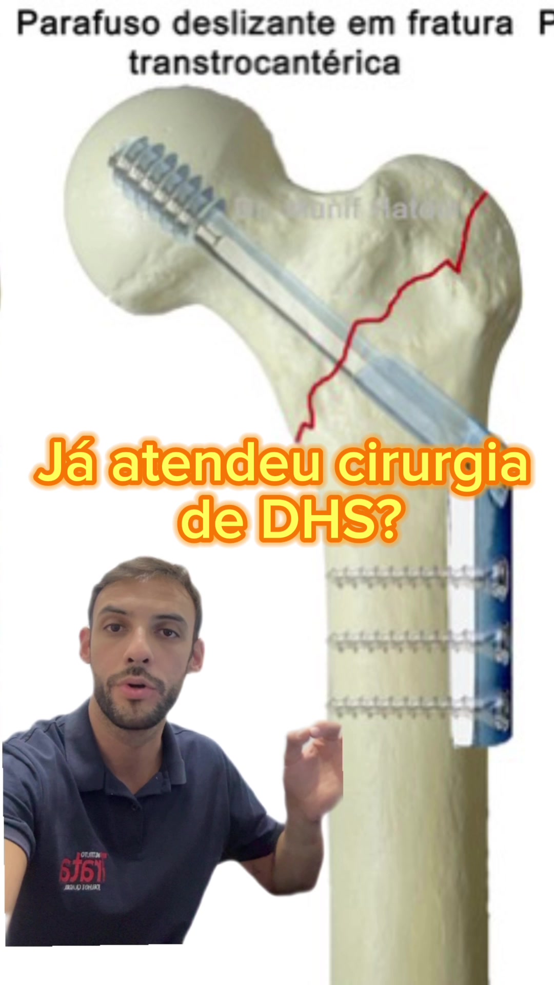 @Vinicius Titico