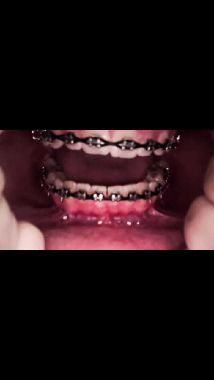 @⭐️//-Asher-//🦷