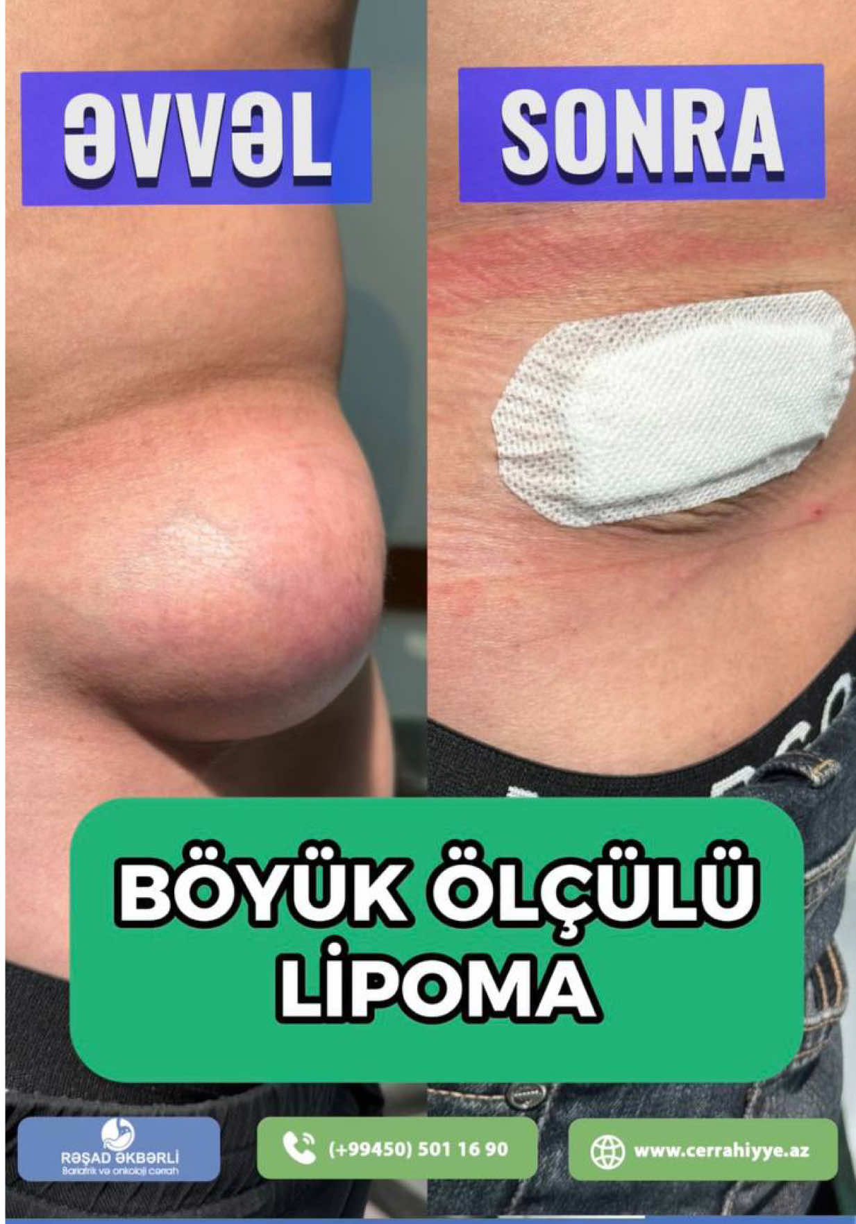 @Ümumi Cərrah Rəşad Əkbərli