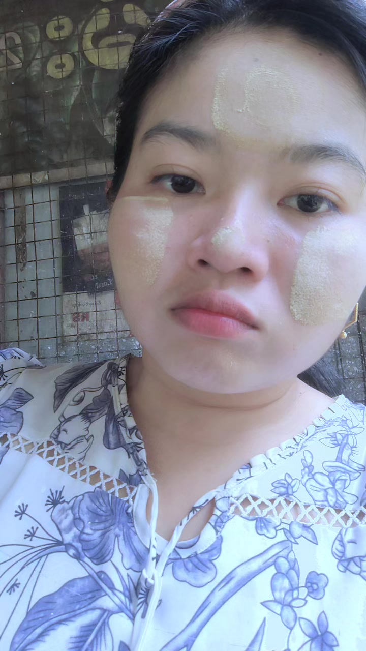 @Nyeinđ¸đŤ(ááźáááşá¸ áá˝ááşá¸ááŹđđ)