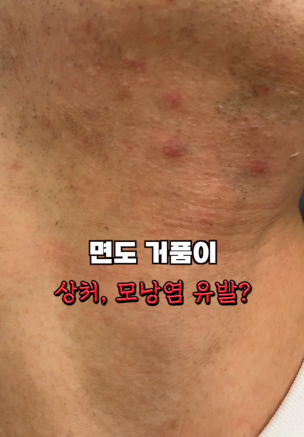 @털털이 TTE