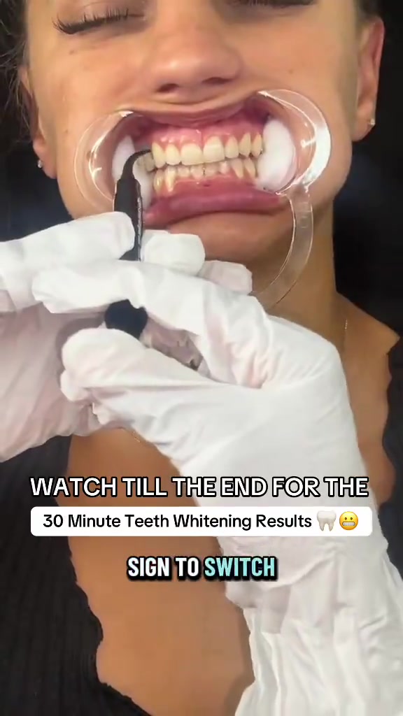 @Diandra | Teeth Whitening Tech