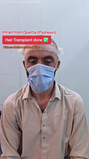 @Dr Asad shalman HairTransplant