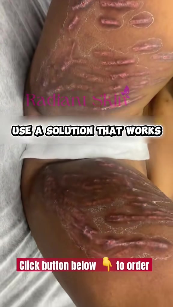 @Radiant skin