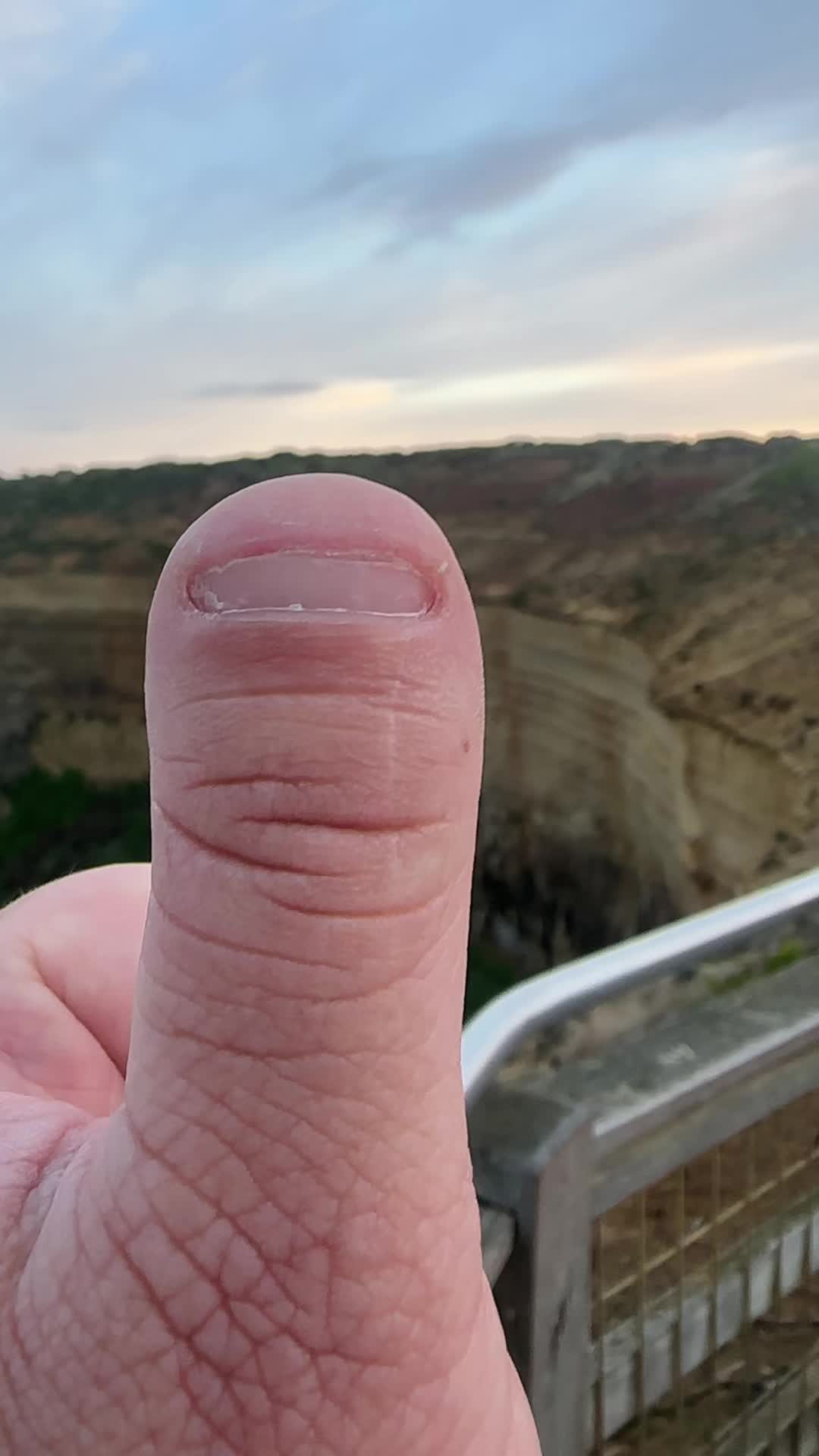 @Thumb on Tour