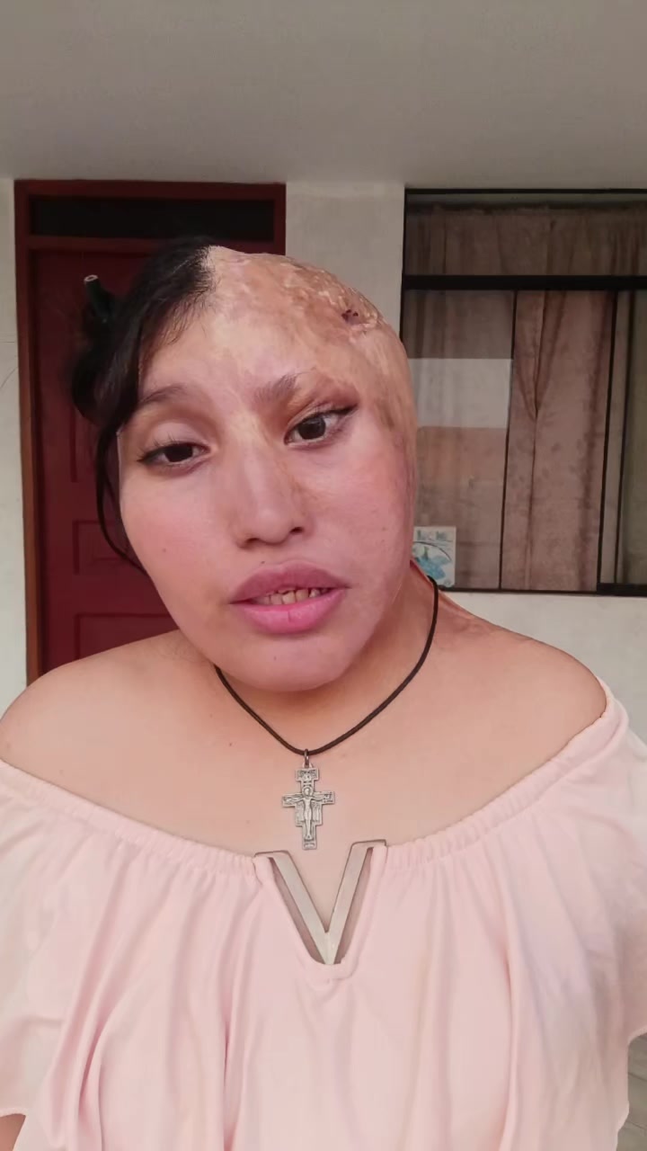 @Elizabeth Carri&oacute;n
