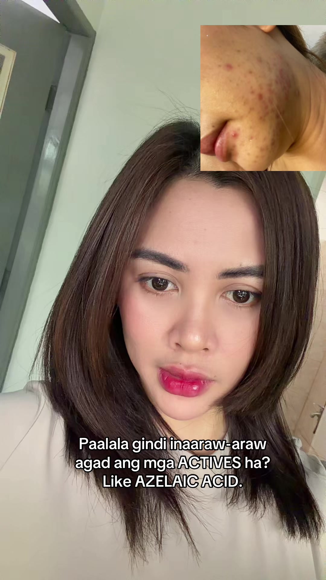 @Ally Feedback Ph