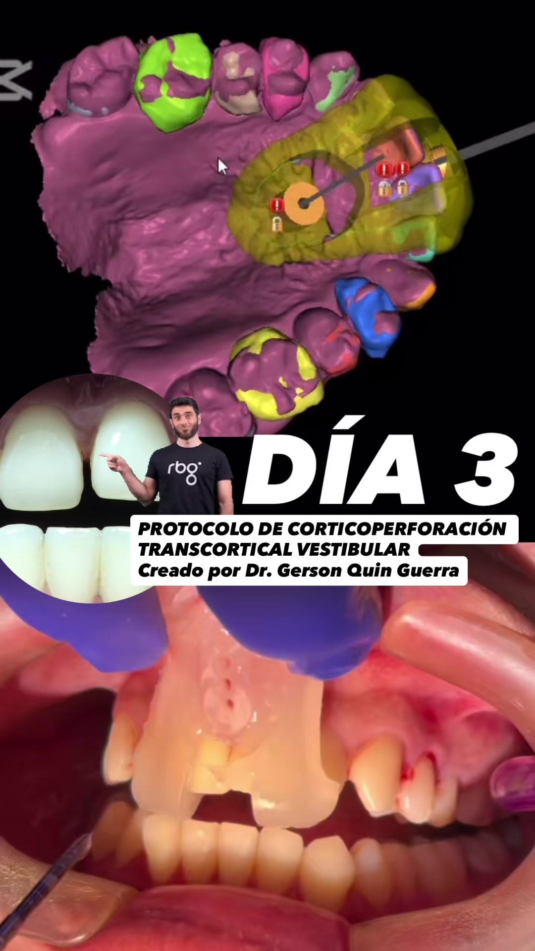 @Dr. Gerson Quin Guerra, PhD