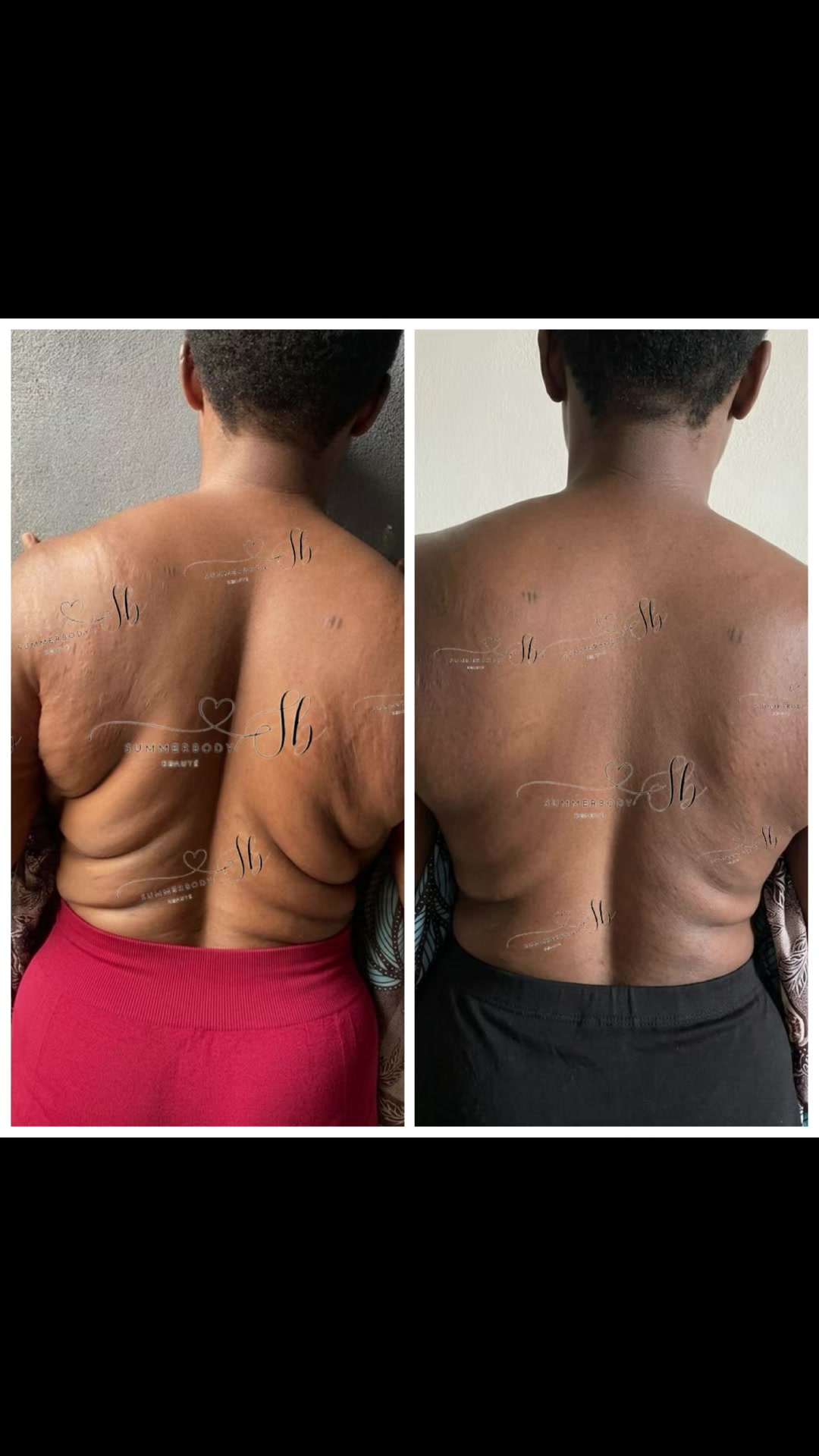 @summerbody
