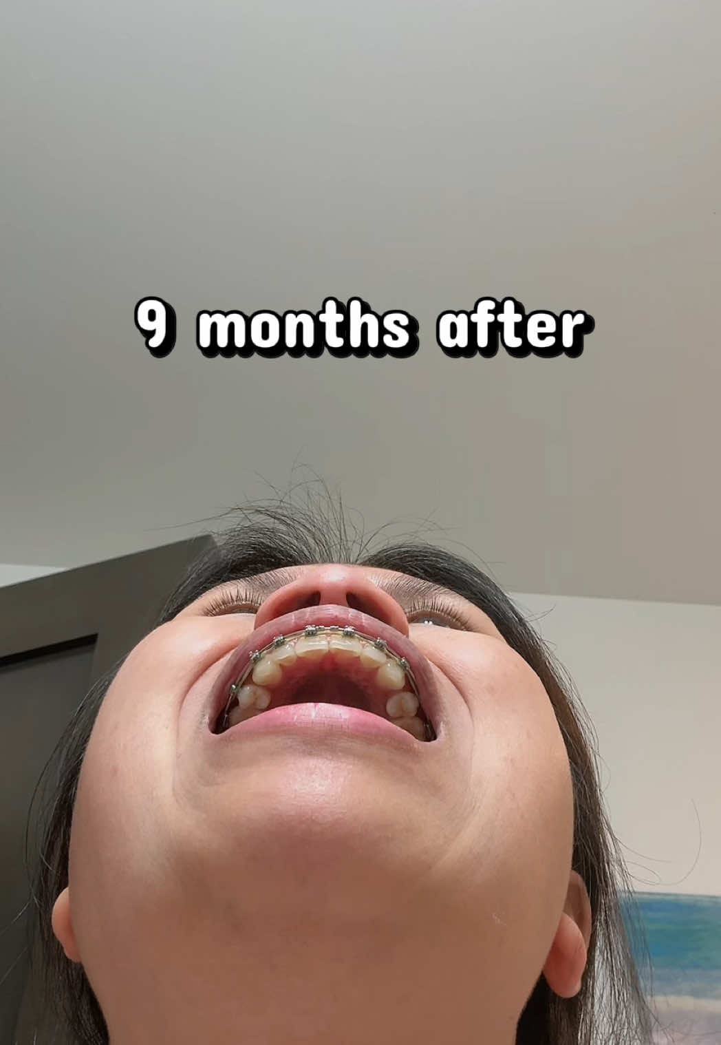 @mey-mey