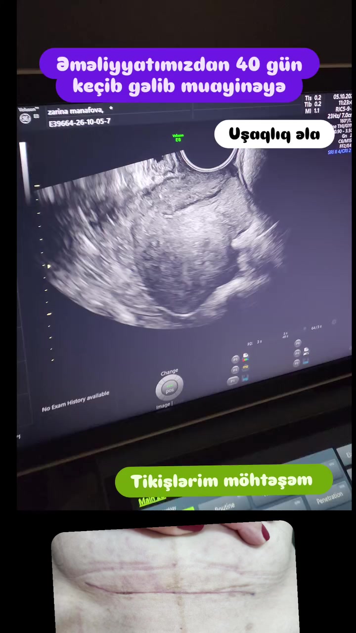 @Ginekoloq Esmira Hasanova