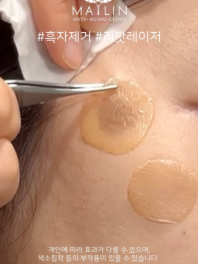 @메이린의원대구점