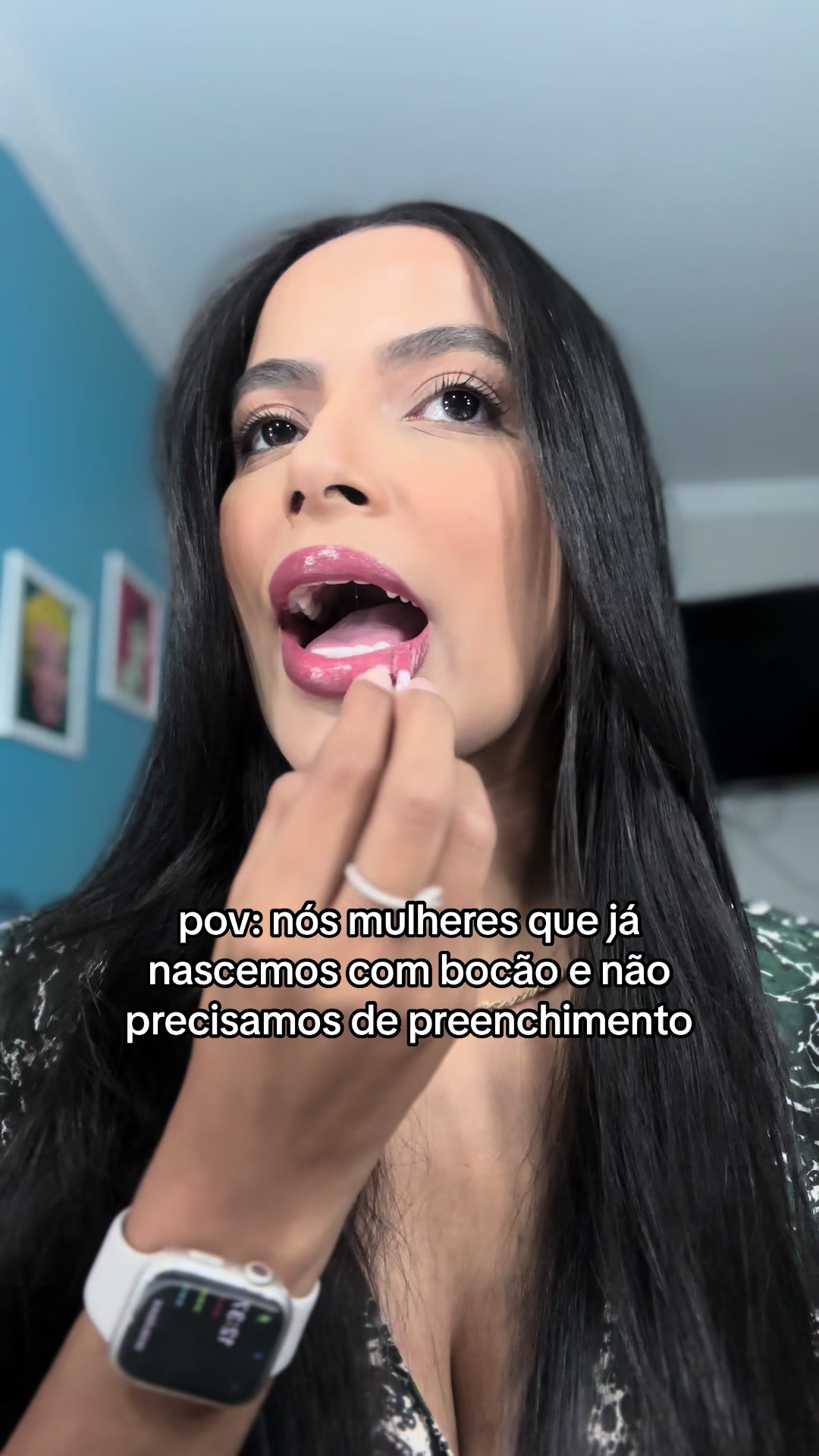 @Bel