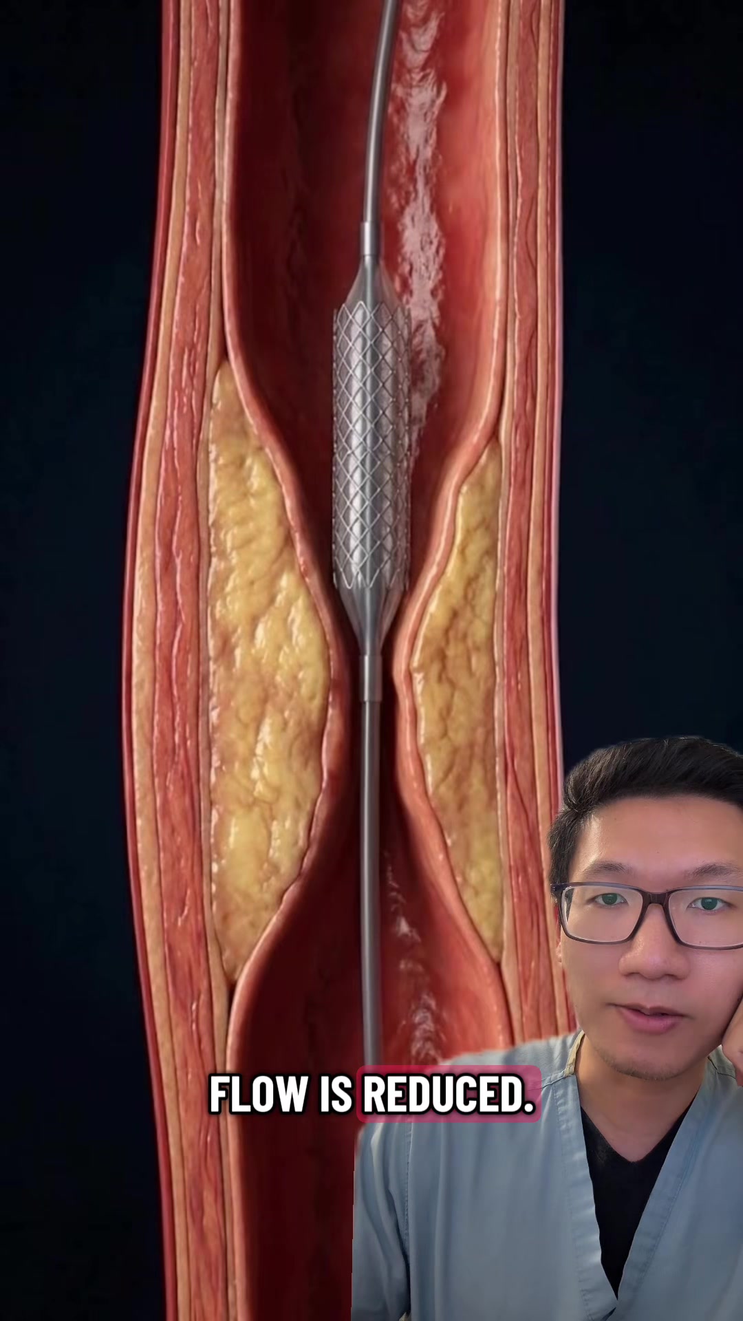 @Dr. Bing, MD MPH