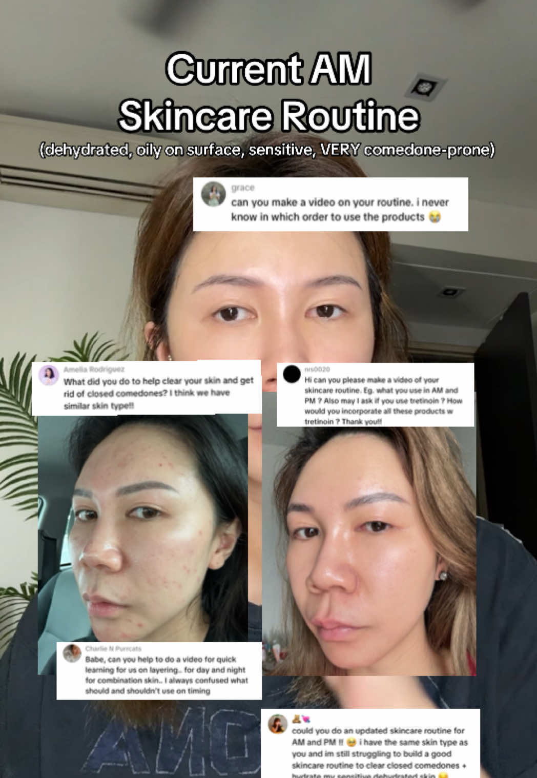 @watermelyn | skin+life