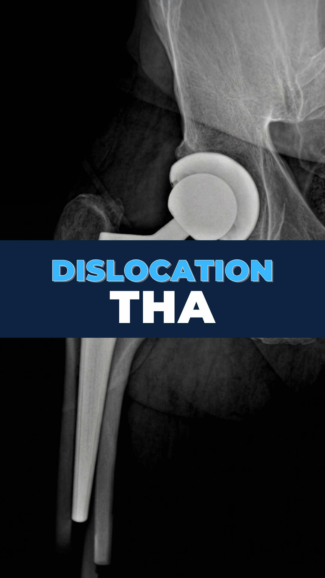 @Bone Doctor - Joint Pain MD