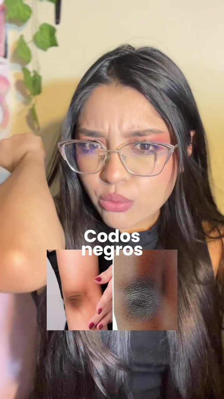 @Ray Skintips