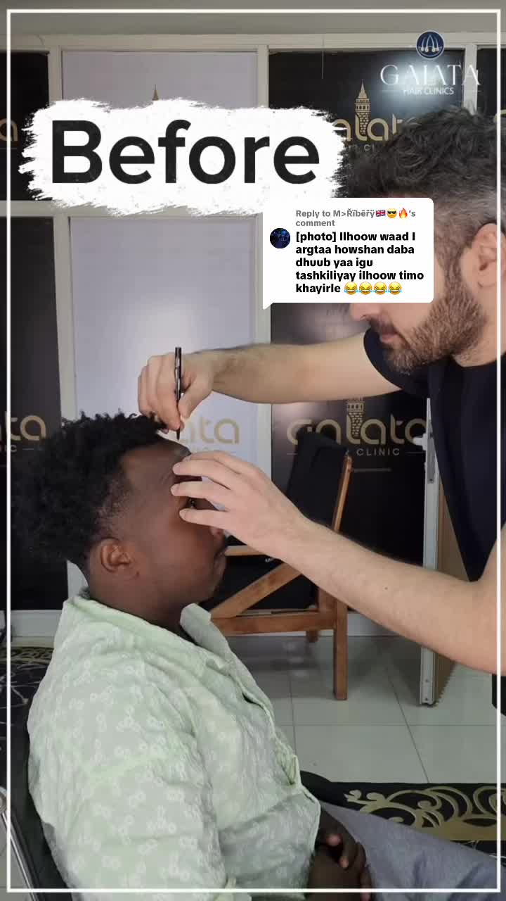 @galata_hair_clinic