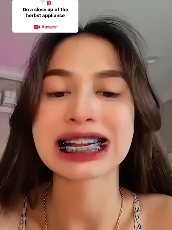 @zaeer.3122