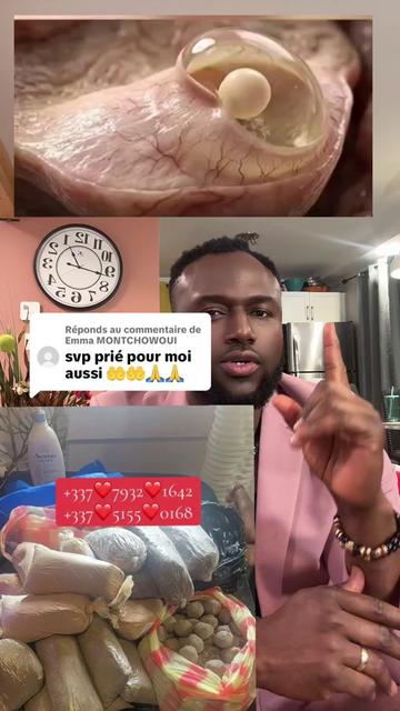 @El professeur facoly fertilité