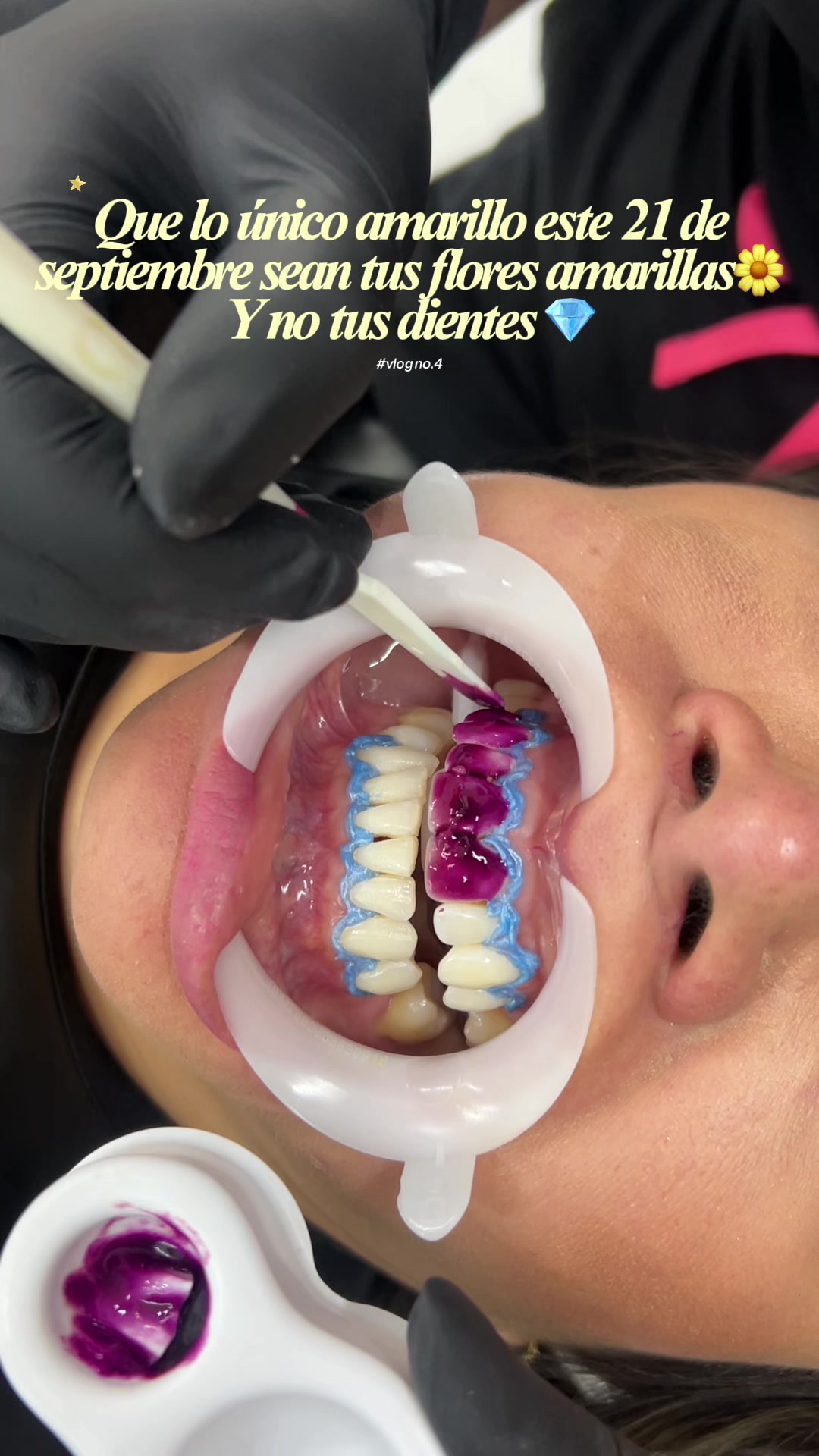 @Cava Clínica Dental 🦷
