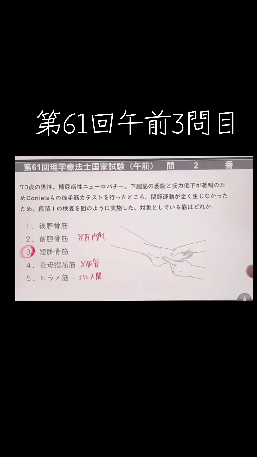 @第62回理学療法士国家試験(ネクストリハアカデミー)