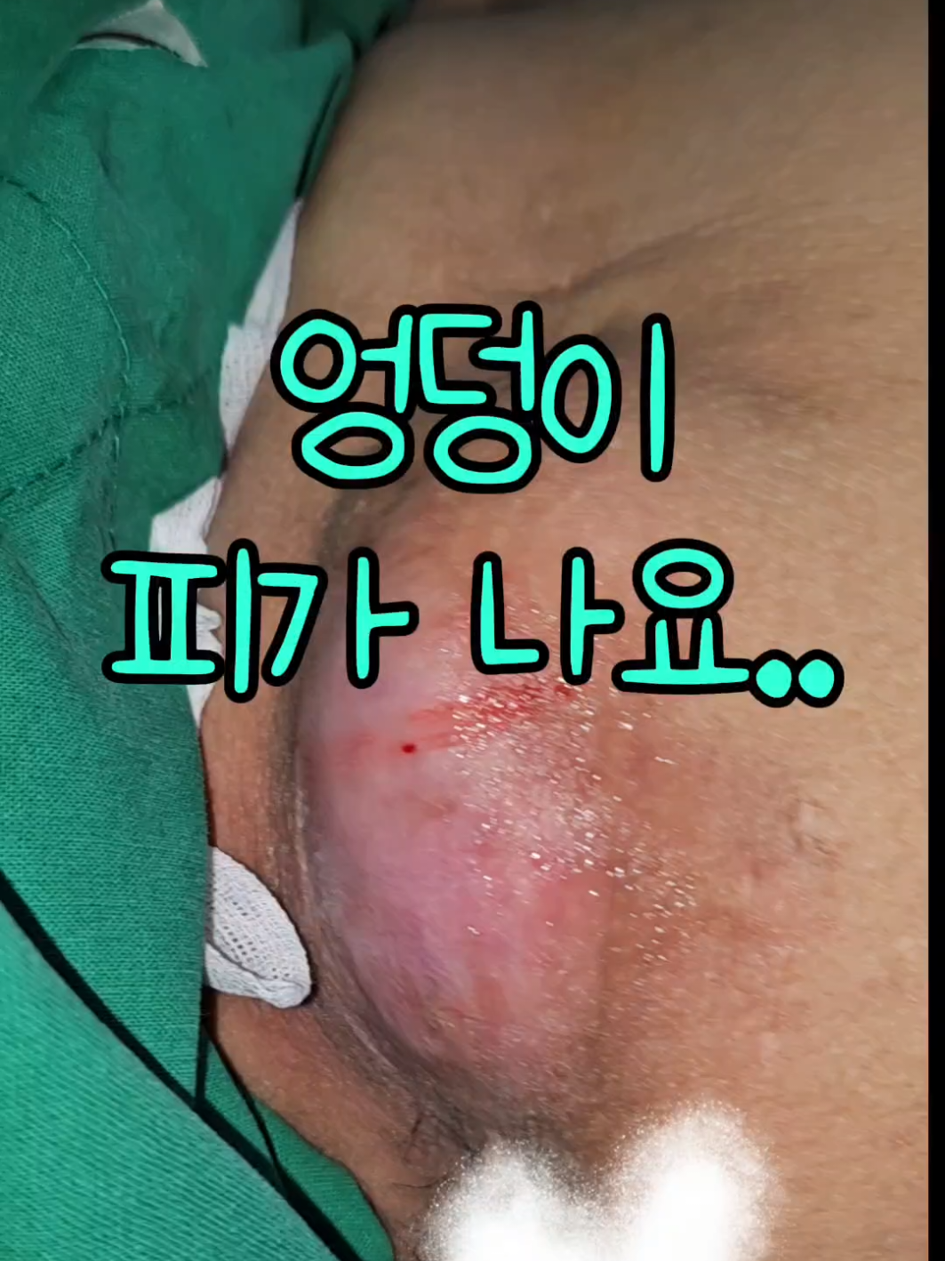 @아문성형외과