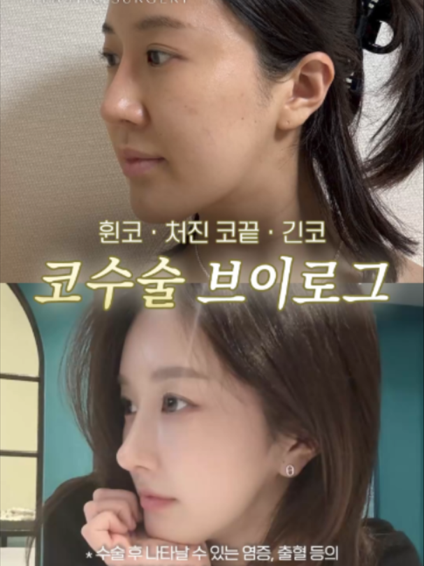 @리셋성형외과
