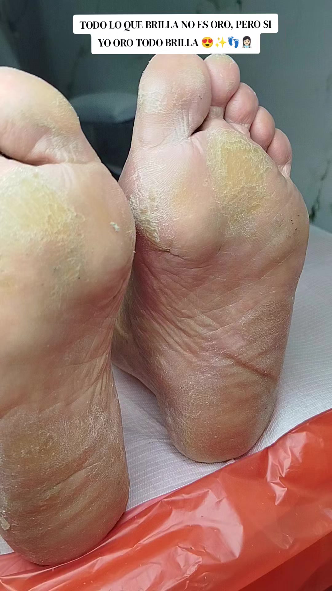 @Podomédical🇵🇪