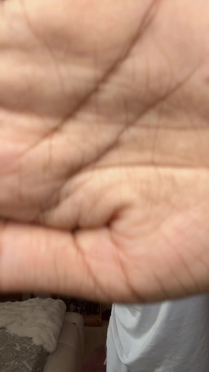@Erta