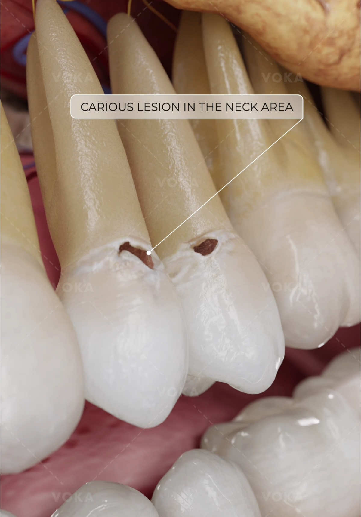 @VOKA 3D Anatomy & Pathology
