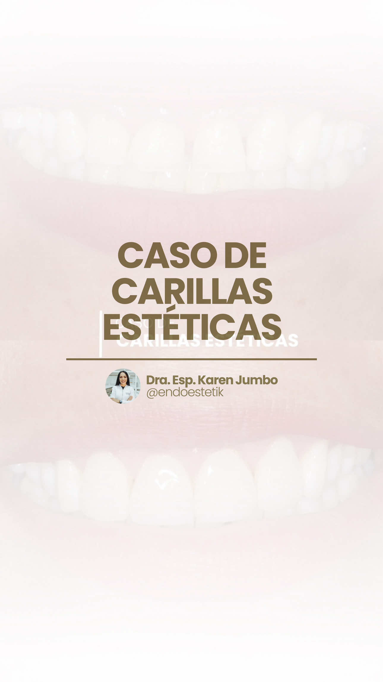 @endoestetik