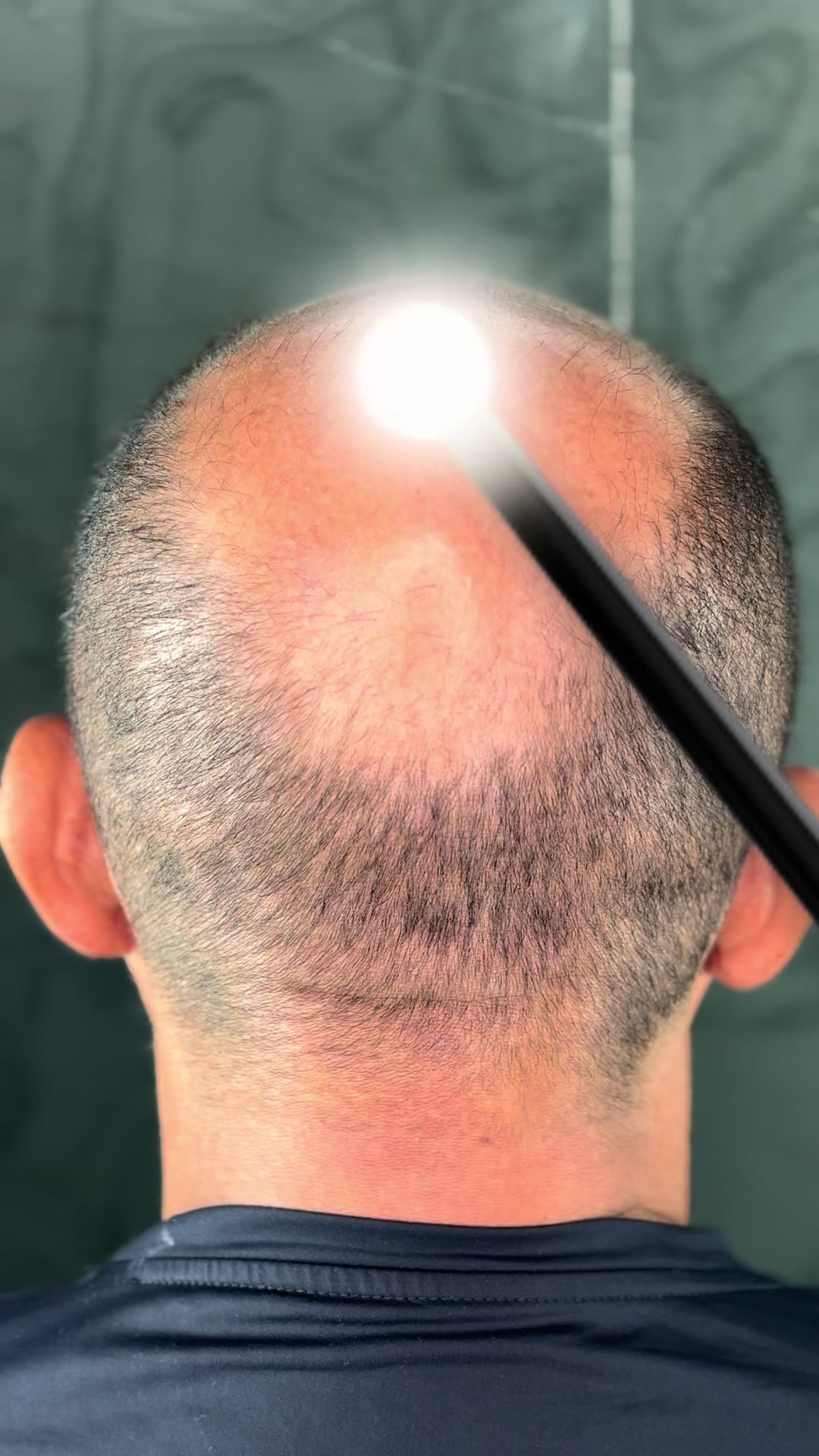 @Valesca Abi Ackel Scalp