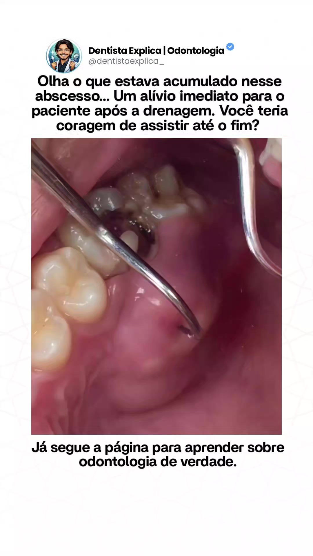 @Dentista Explica | Odontologia
