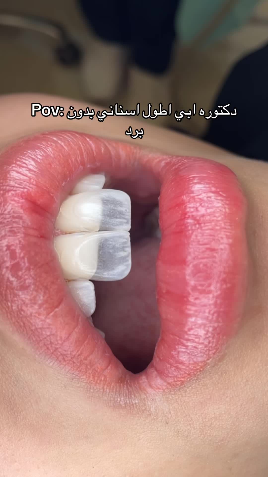 @Dr. Abrar Alhababi