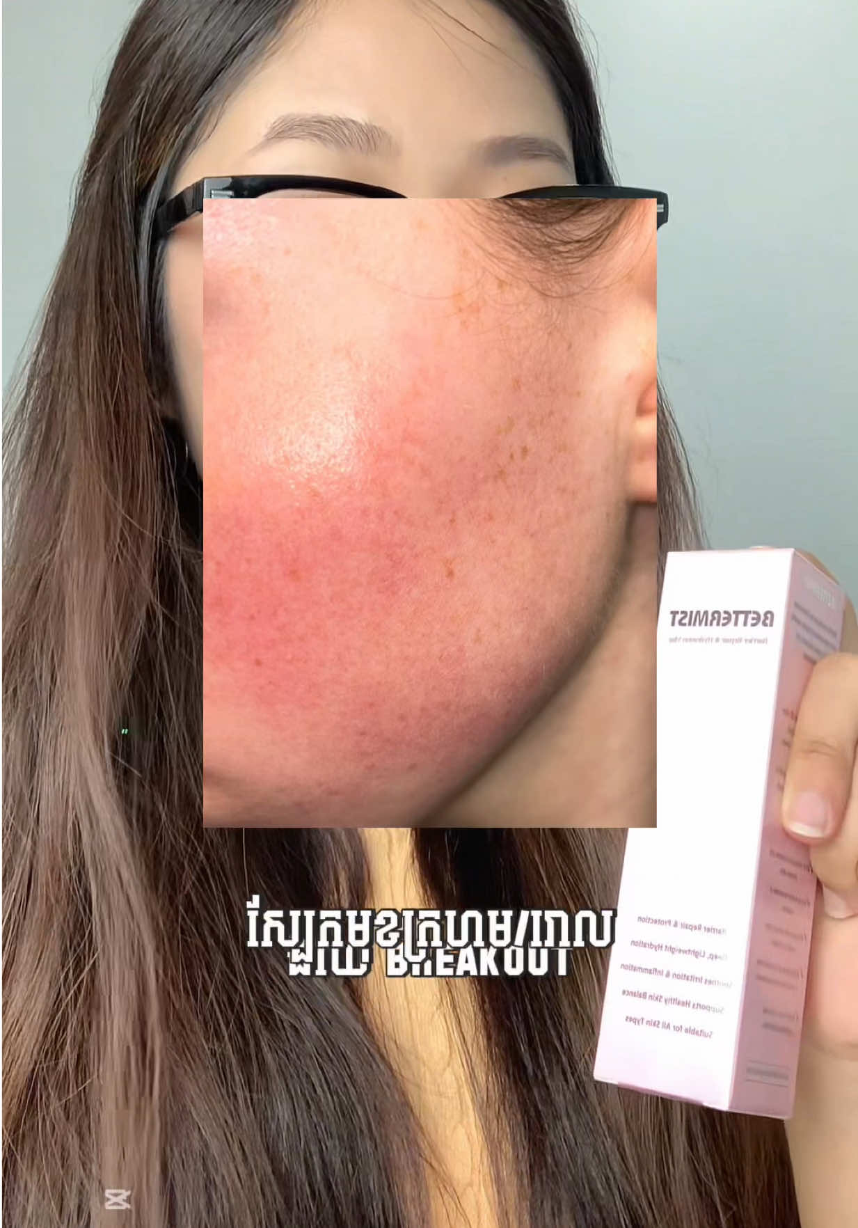 @BetterSkin