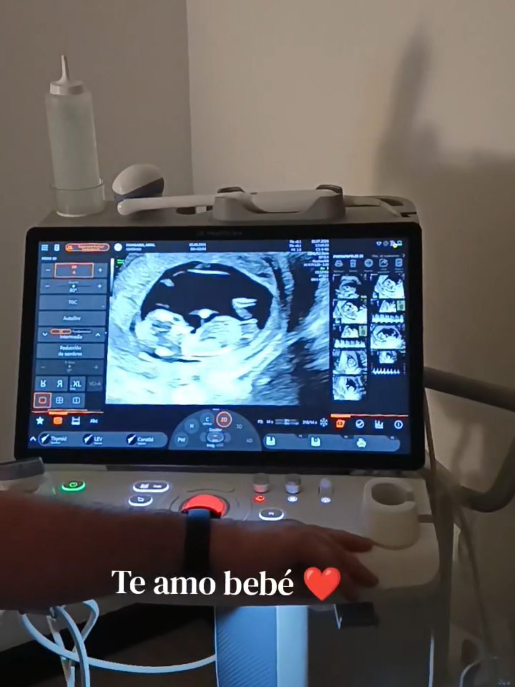 @Abril.Mangano