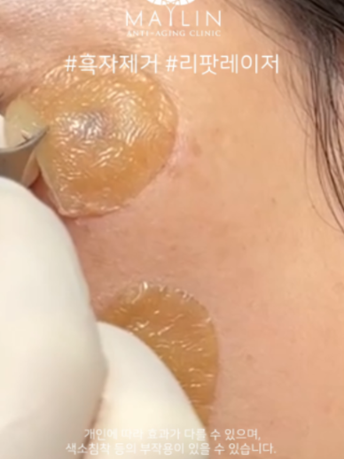 @메이린의원대구점