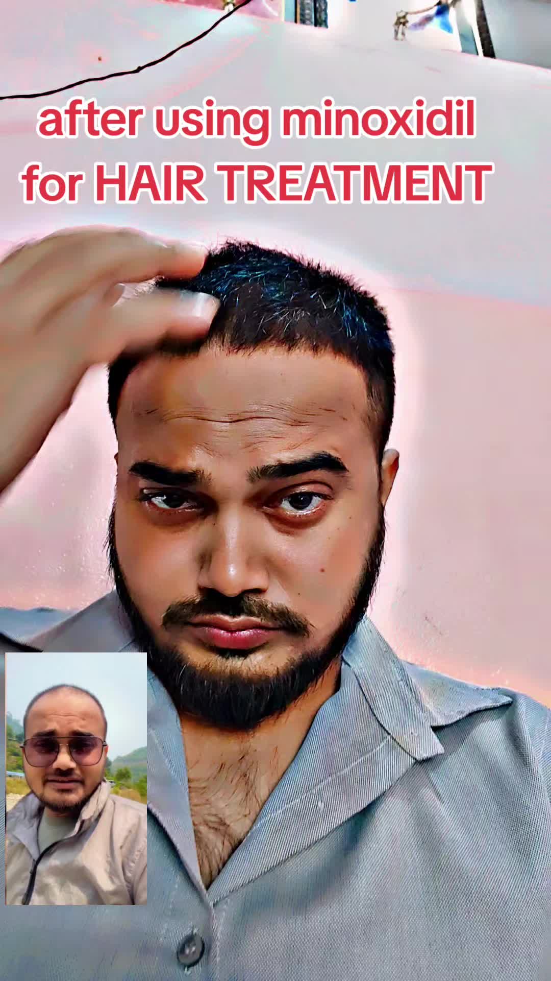 @DipeshSingh. 🕸🕷
