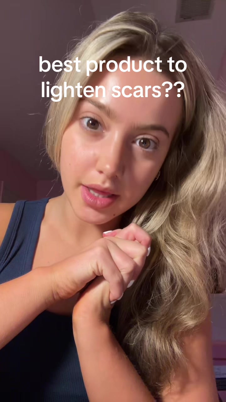 @cheeto🙈