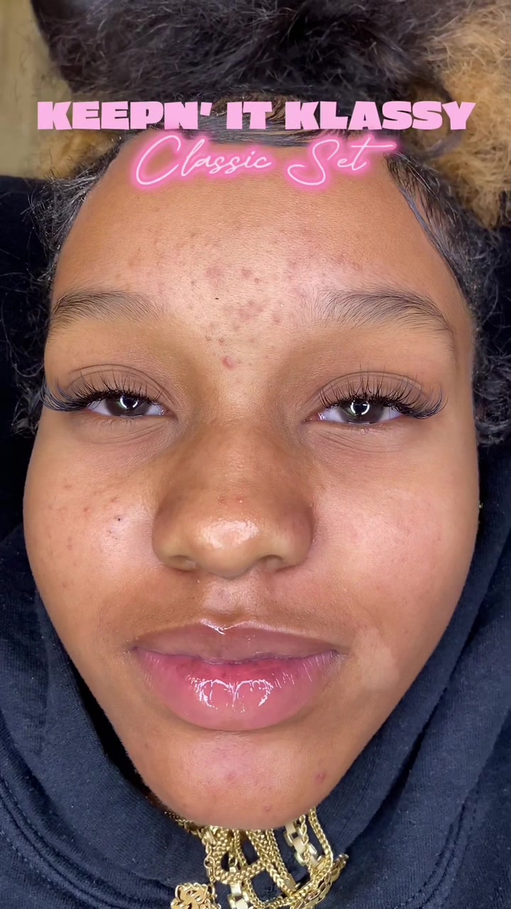@KlassyBlinks