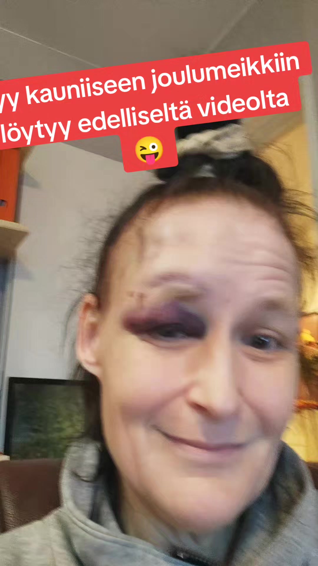 @Maaku75