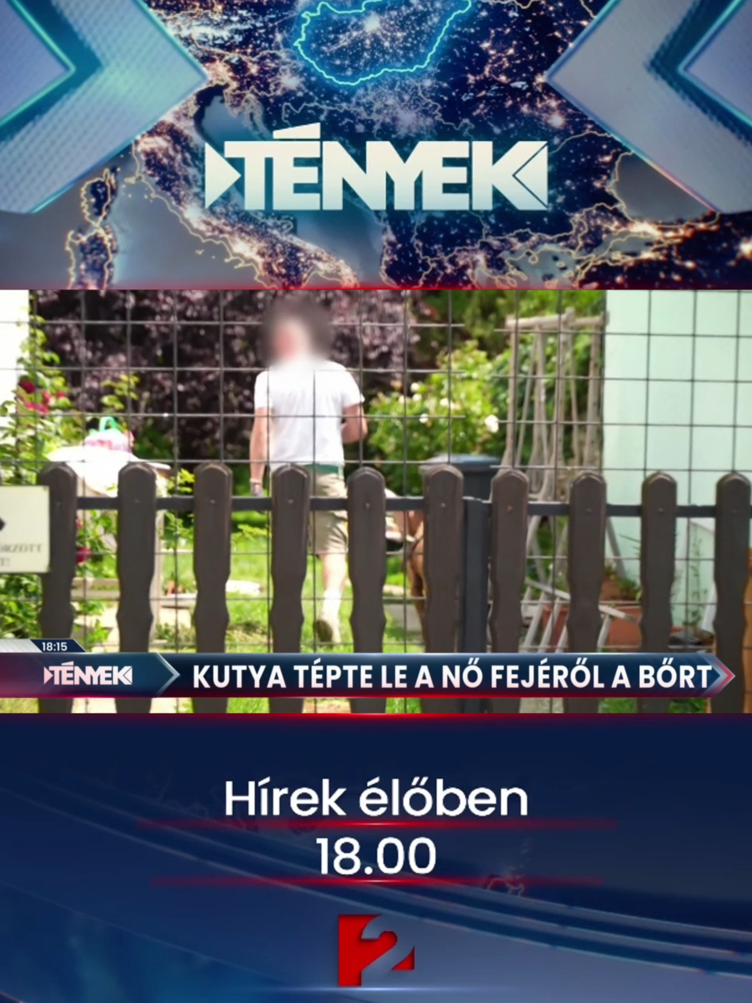 @TV2 T&eacute;nyek