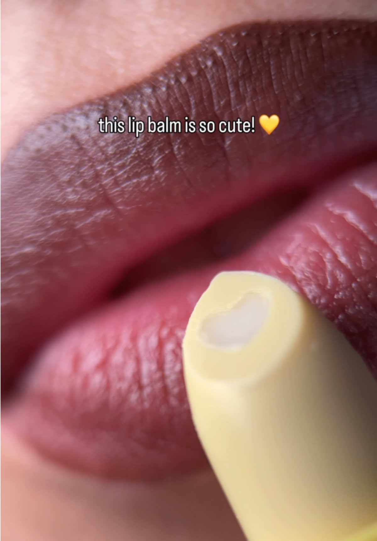@Noelle