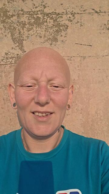 @baldies_adventures