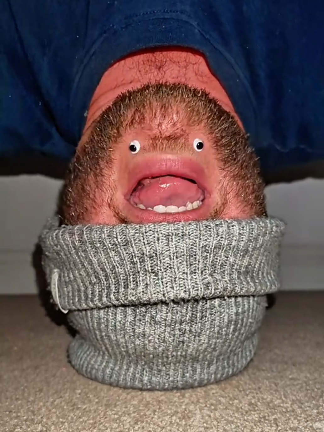 @Chinfaced