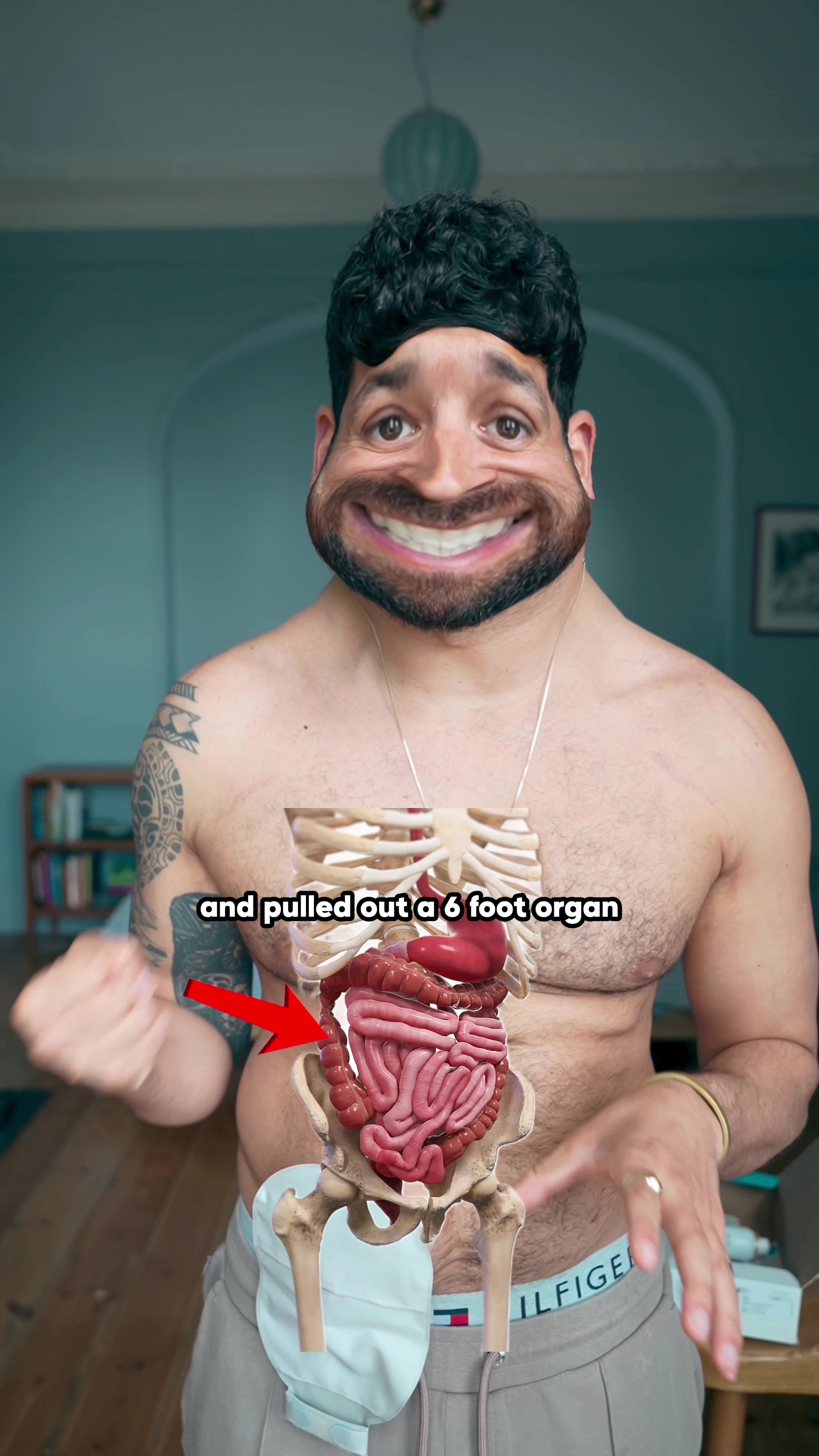 @Mr.Colitiscrohns