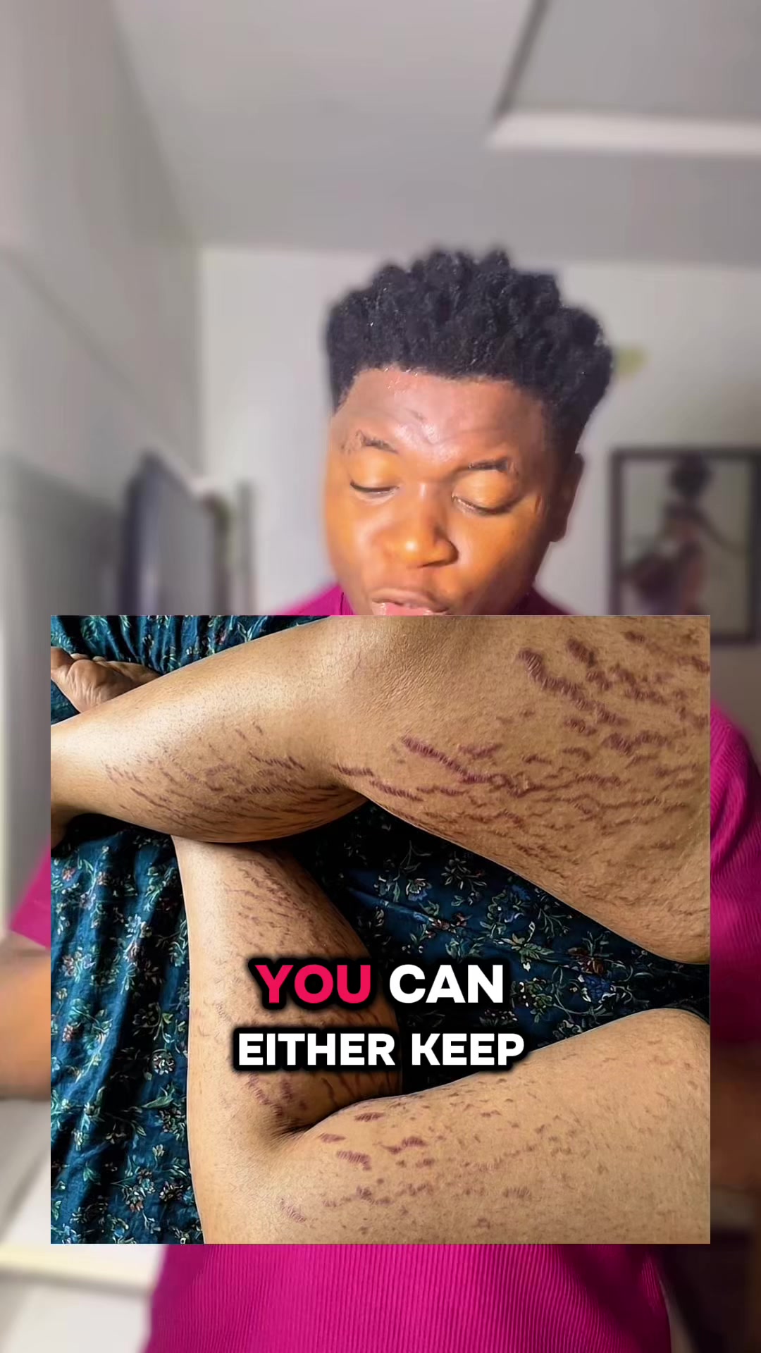 @Radiant skin